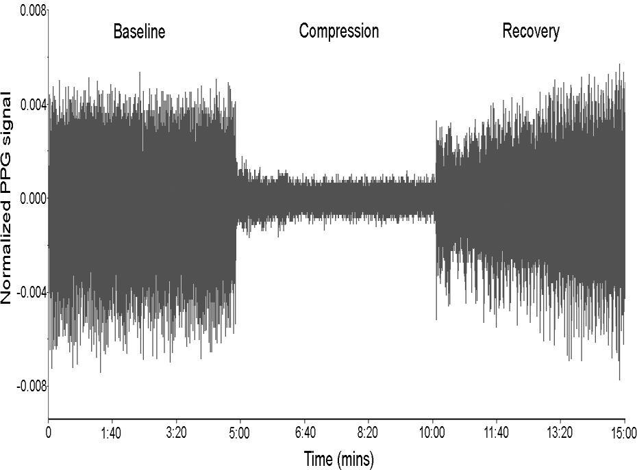 Figure 4. 15-minute recording of infrared PPG from the spinal cord before, during and after compression.