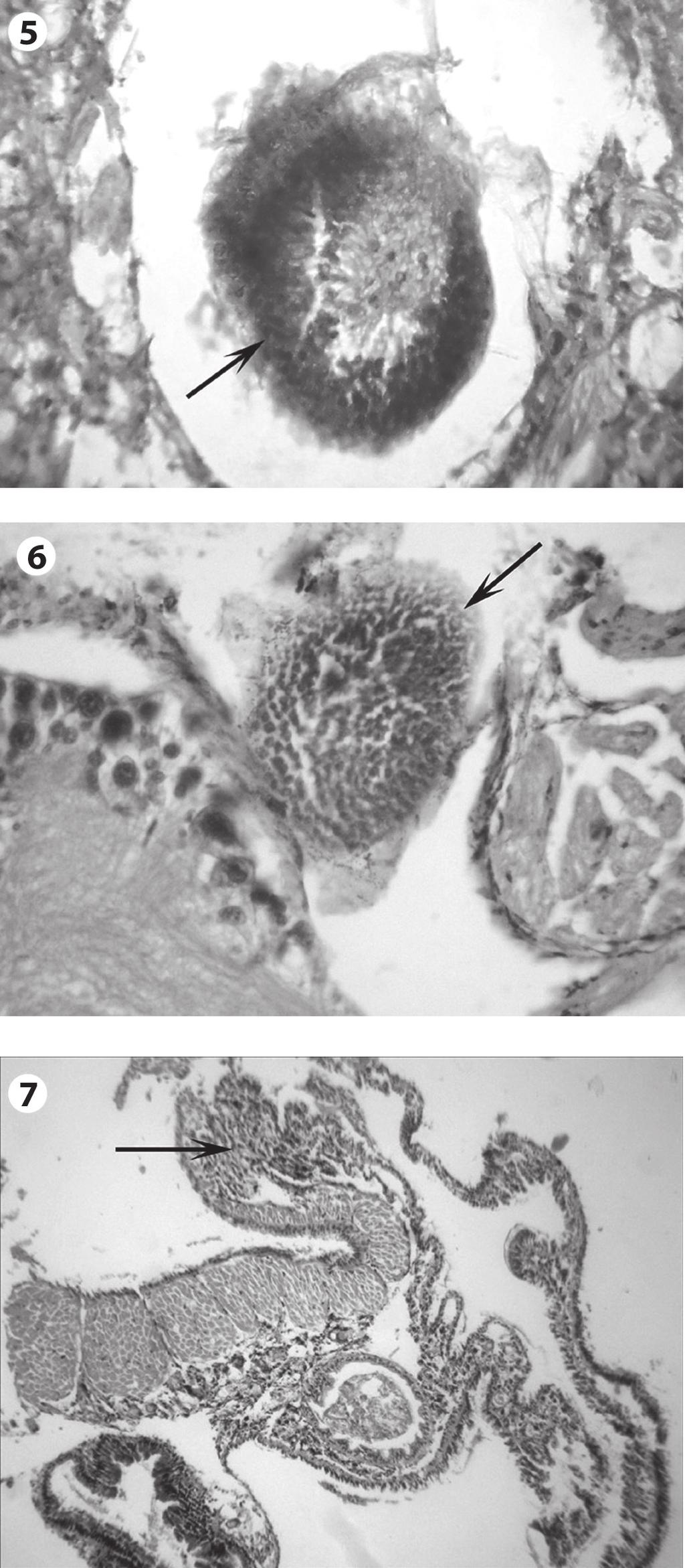Loose hemocyte rich nodules were present in between the organs (Fig. 6).