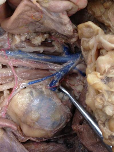 Notice the thick vein exiting the blue lump structure (the kidney) The