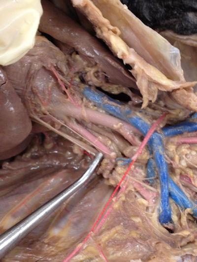 Notice the lungs Notice the lump in the middle (the heart) Notice the arteries coming out the of the heart