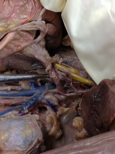 Notice the location of the kidneys Notice the intestines The