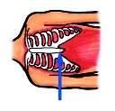 JAW THRUST In some instances involving injuries or illness, the casualty s airway may be difficult to open. An alternative method of airway maintenance is the jaw thrust.