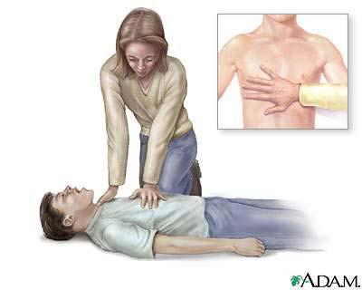 Cardiopulmonary Resuscitation Cardiopulmonary resuscitation (CPR) is expired air resuscitation (EAR) used in conjunction with external cardiac compressions (ECC).