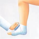 A good bandage should tightly surround the leg on all sides, decrease in pressure from the distal to the proximal side and does not constrict the leg anywhere.