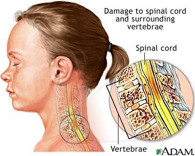 It is the spinal cord, through its attached nerve roots, which provides the means by which we breathe, move and sense.