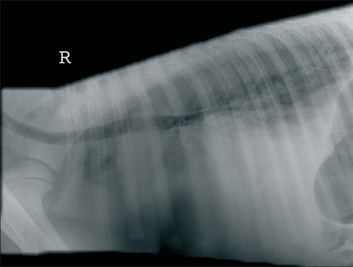 Aspiration pneumonia in a foal.