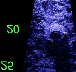 sonar for wide area imaging with a higher frequency, shorter range, but higher resolution sonar