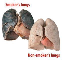 Smoking & Health Tar smokers cough - bronchitis Nicotine addictive damages heart/lungs