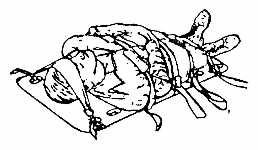 Figure 2-6. Casualty secured to a long spine board. 2-7.