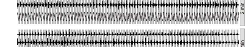 speed A continuous sequence (6 min) of