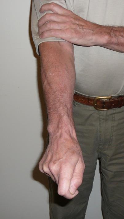 Different portions in the elbow joint allow the arm to bend or straighten at the elbow and to rotate clockwise and counter-clockwise at the elbow.