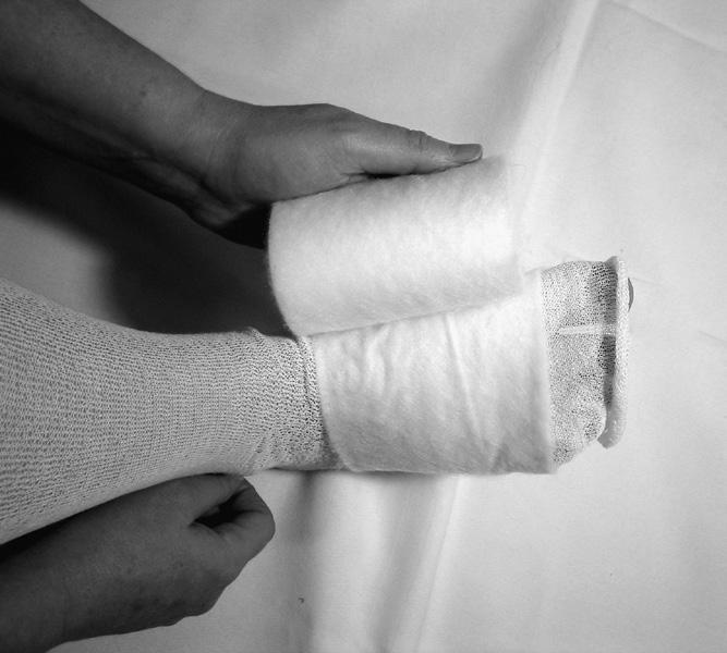 Page 3 of 6 4. Wrap the roll of cotton padding around your foot and ankle. Your therapist will tell you which method to use. Notes: Simple method: a. Start at the ba