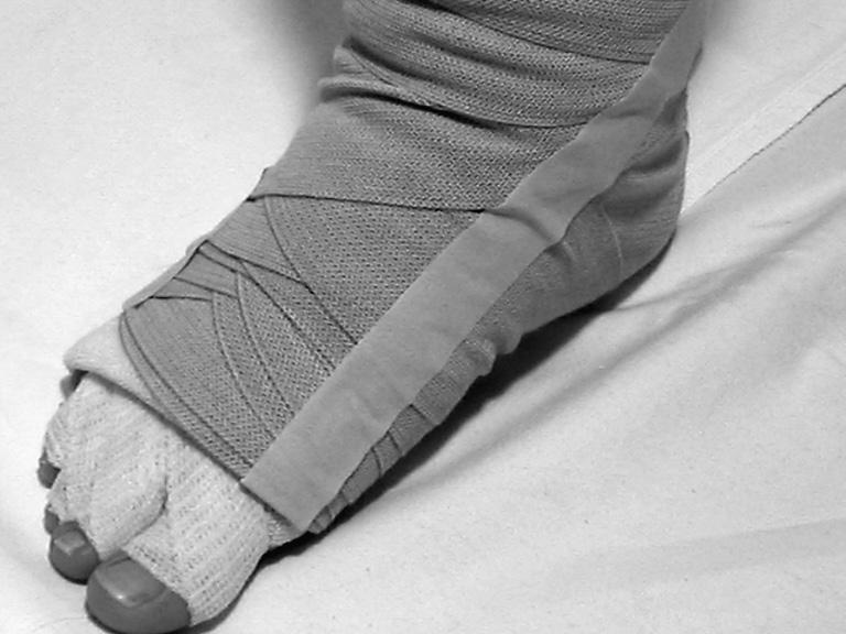 b. Wrap around the ankle. You will overlap the bandage that s around the heel. c. Wrap around the sole of the foot.