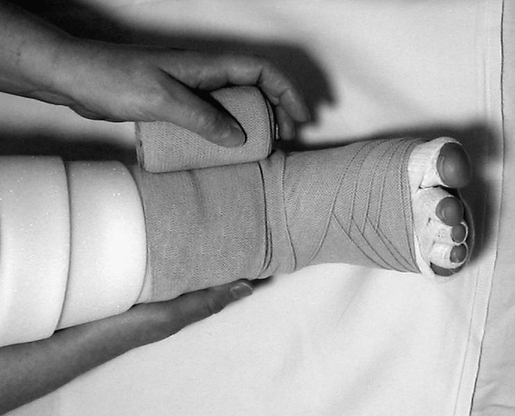 ndage width. End just below the knee. b. Repeat with another 10 cm 5 m bandage (optional). c. Tape the bandage in place. 10 11.