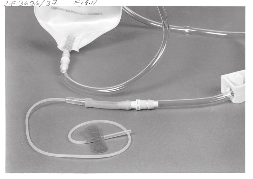 (Figure 9). Venous pressure is altered by varying the height of the IV bag. A height of 18" is a good starting point.