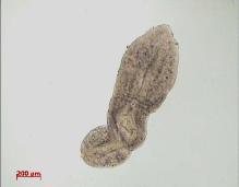 Dactylogyrus difformis from gills. D.