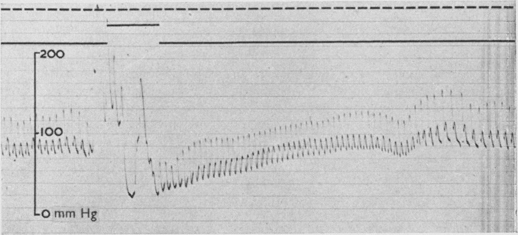 Blood pressure then rose gradually to the control level (Fig. 2). During the early part of this period forearm flow was increased, indicating vasodilatation of muscle vessels (Fig. 3). Fig. 1.