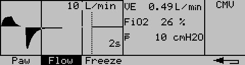 Operation Displaying Waveforms and Measured Values Displaying Waveforms and Measured Values Pressure Waveform Paw From the Monitoring menu, press menu keys»graph«and»paw«.