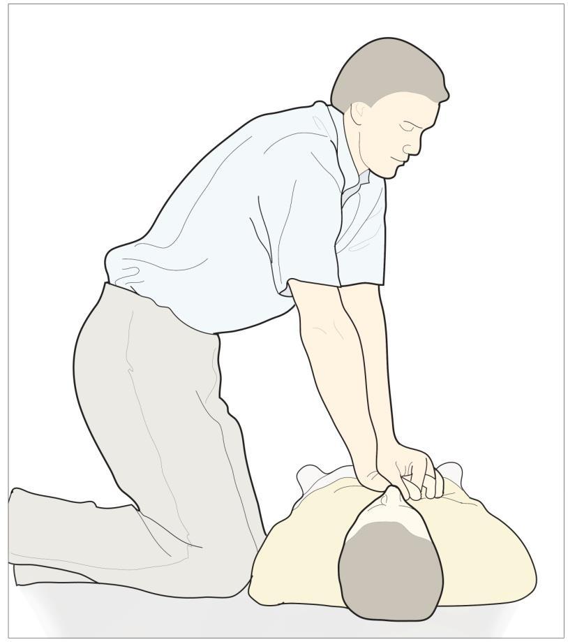 Continuation of CPR Continuation of CPR Continue with