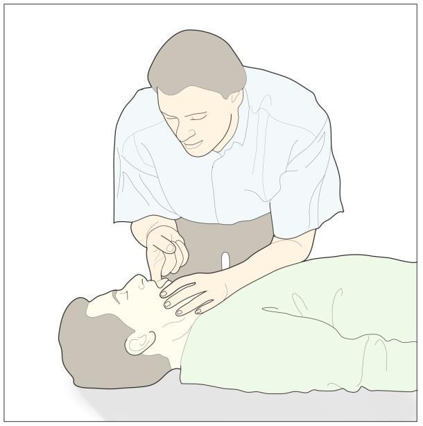 No Chest Rise If the chest does not rise with rescue breaths: Before the next attempt: Check the patients mouth and remove visible obstruction Recheck that there is adequate head tilt and chin lift
