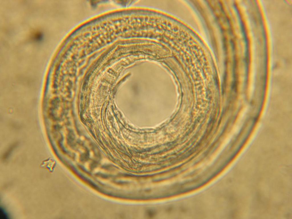 30 200 µm Figure 11.