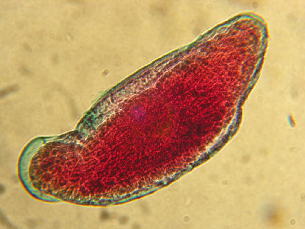 39 200 µm Figure 19. Unidentified leech (B. phalera (?