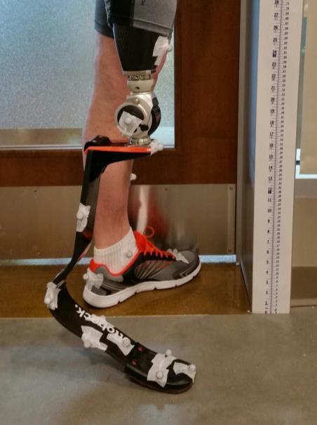 71 than 0 even when the prosthetic knee joint is fully extended (Figure 3.14); this angle does not reflect a knee flexion contracture. Figure 3.14. Apparent knee flexion due to the ankle joint center defined posterior to the knee joint center.
