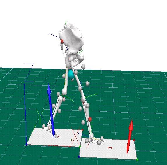 The data was analysed by Visual 3D software (professional version). The Gait report was generated for each volunteers and comparison was made.