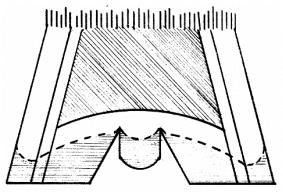 Fig.4a Fig. 4b Fig. 4c Fig 4a represents a hoof capsule with the collateral grooves lifted too high off the ground by excess sole and wall.