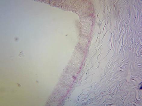 The stratified mucous epithelia and columnar cells of the oesogaster were Alcian blue negative (Fig. 6), Periodic Acid Schiff (PAS) positive (Fig. 7).