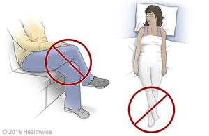Hip Replacement (Posterior) Precautions: Don't cross your legs slide 3 of 3 1. Imagine there's a line running down the middle of your body. Keep your legs from crossing over it. 1. Don't cross your legs when you sit.