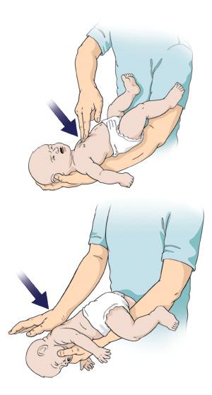 What to do if it is an infant?