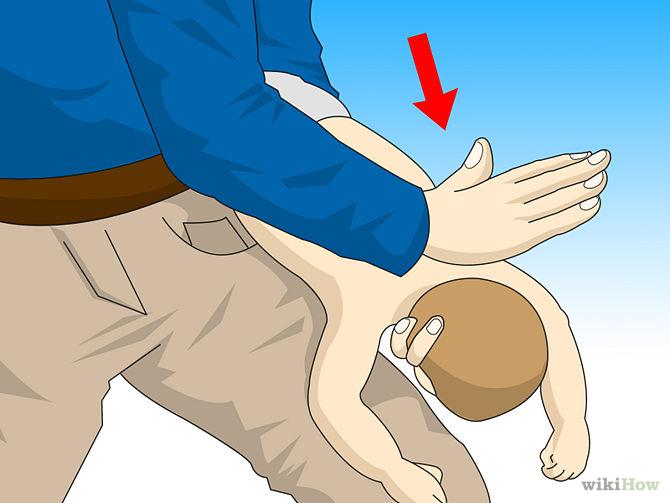 o Turn the infant over and to your other thigh, this time the infant will be facing upwards and this time the arm that you slapped with becomes the support underneath the infant s body and its head &