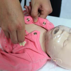 If using standard (adult) pads, do not let the pads touch. For infants less than a year old, a manual defibrillator should be used if available.