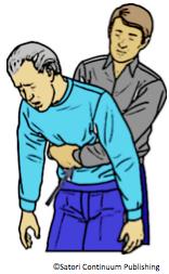 ABDOMINAL THRUSTS (HEIMLICH MANEUVER) The Heimlich maneuver should only be used when a victim is responsive and older than one year of age. To do the Heimlich maneuver: 1.