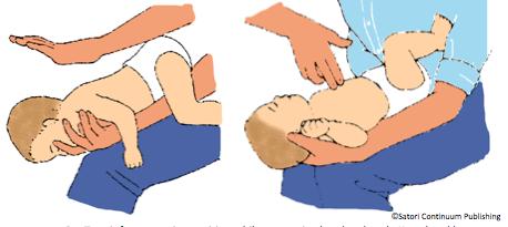 BACK BLOWS AND CHEST THRUSTS IN INFANTS Instead of the Heimlich maneuver, use back blows and chest thrusts on a choking but responsive infant less than one year old. 1. Hold the child in your lap. 2.