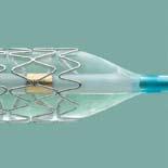balloon performance for optimal stenting results.