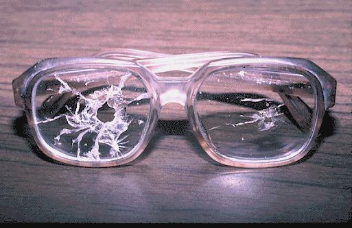 SO USE THEM! Remember: Safety Glasses WORK!! These glasses saved the vision of a laboratory worker.
