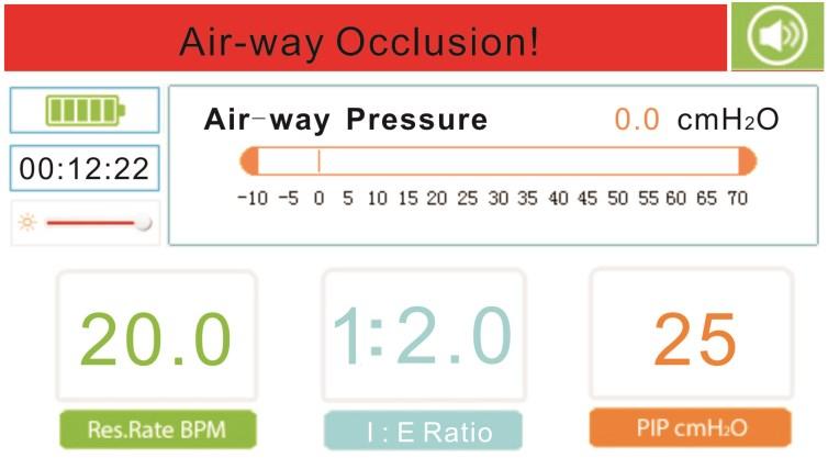 Figure 11-5 If the operating status pane shows information of High Air-way Pressure!