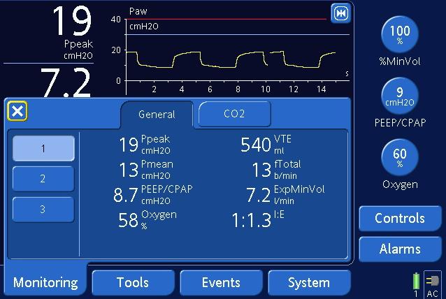 Easy-to-understand monitoring Ventilators display large amounts of data that is often difficult to interpret.