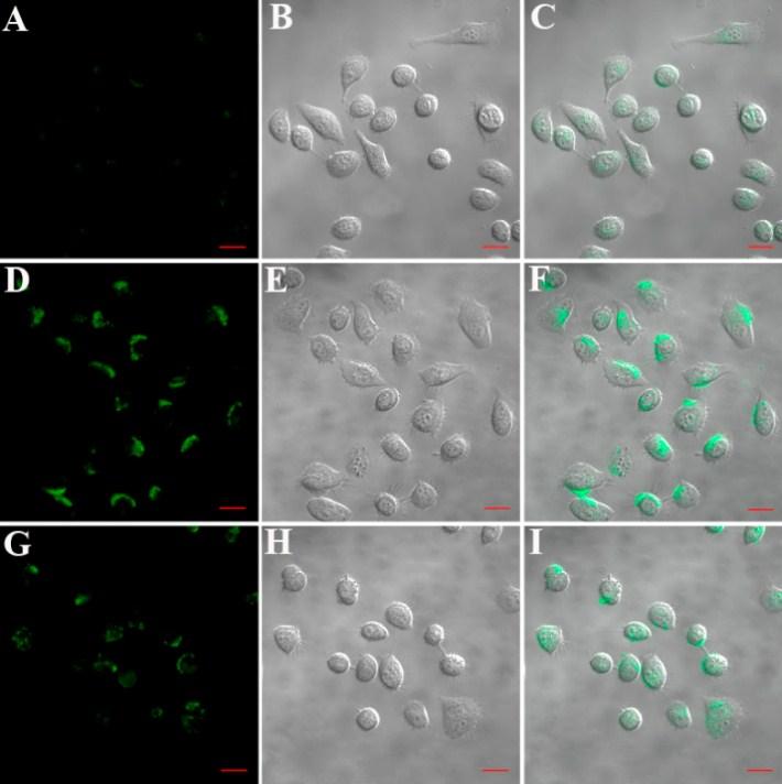 Confocal microscopy images of A549 cells after incubation in different conditions: (A-C) P1/GO nanoprobe and dntp, (D-F) primer-dna, dntp