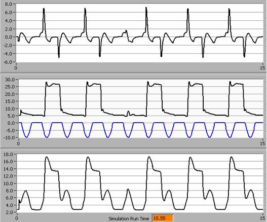 Volume Pressure Flow Answer: B consistent mandatory V T inspiratory time too long Freq.