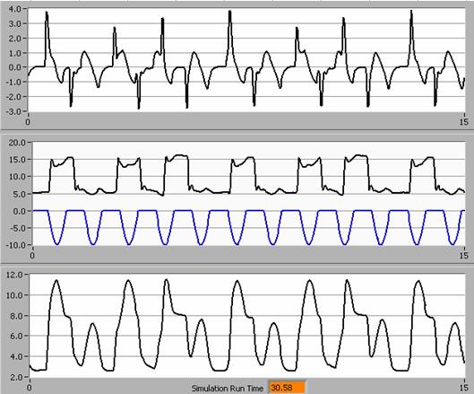 Volume Pressure Flow PC-CMV patient triggered ventilation inspiratory time too long