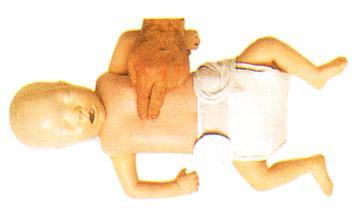 INFANT CPR Definition Infant CPR is administered to any victim under the age of 12 months (except for newborns in the first hours after birth).