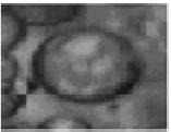 Fig. 2(b) is an image with low photographic quality In our proposed approach, the process for the detection of the drops in an image has