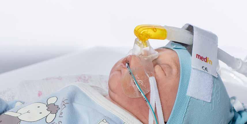Miniflow Passive ncpap interface Miniflow is our interface for CPAP/NIV therapy using conventional ventilators.