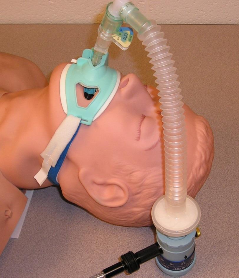 ALS Automatic Use Confirm ventilation Breath Sounds End tidal CO 2