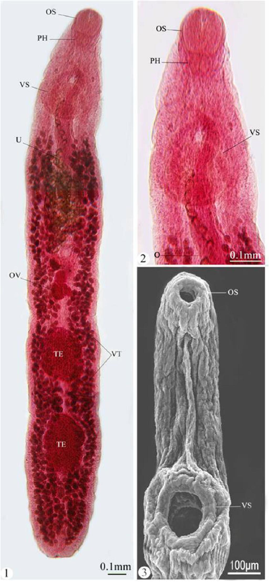 Figs.1, 2: Photomicrographs of the adult Proenenterum sp.