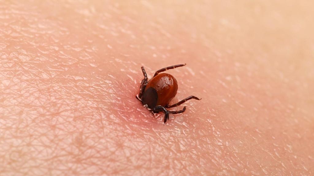 LYME DISEASE Fastest growing vector-borne infectious disease in the US Reported annual cases increased