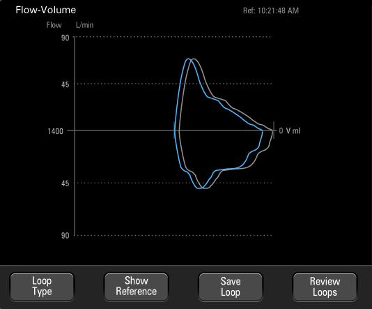 Parameter Monitoring (Waveforms) Operations Flow-Volume Spirometry Loop FIGURE 5-16 is an example of the Flow-Volume loop.